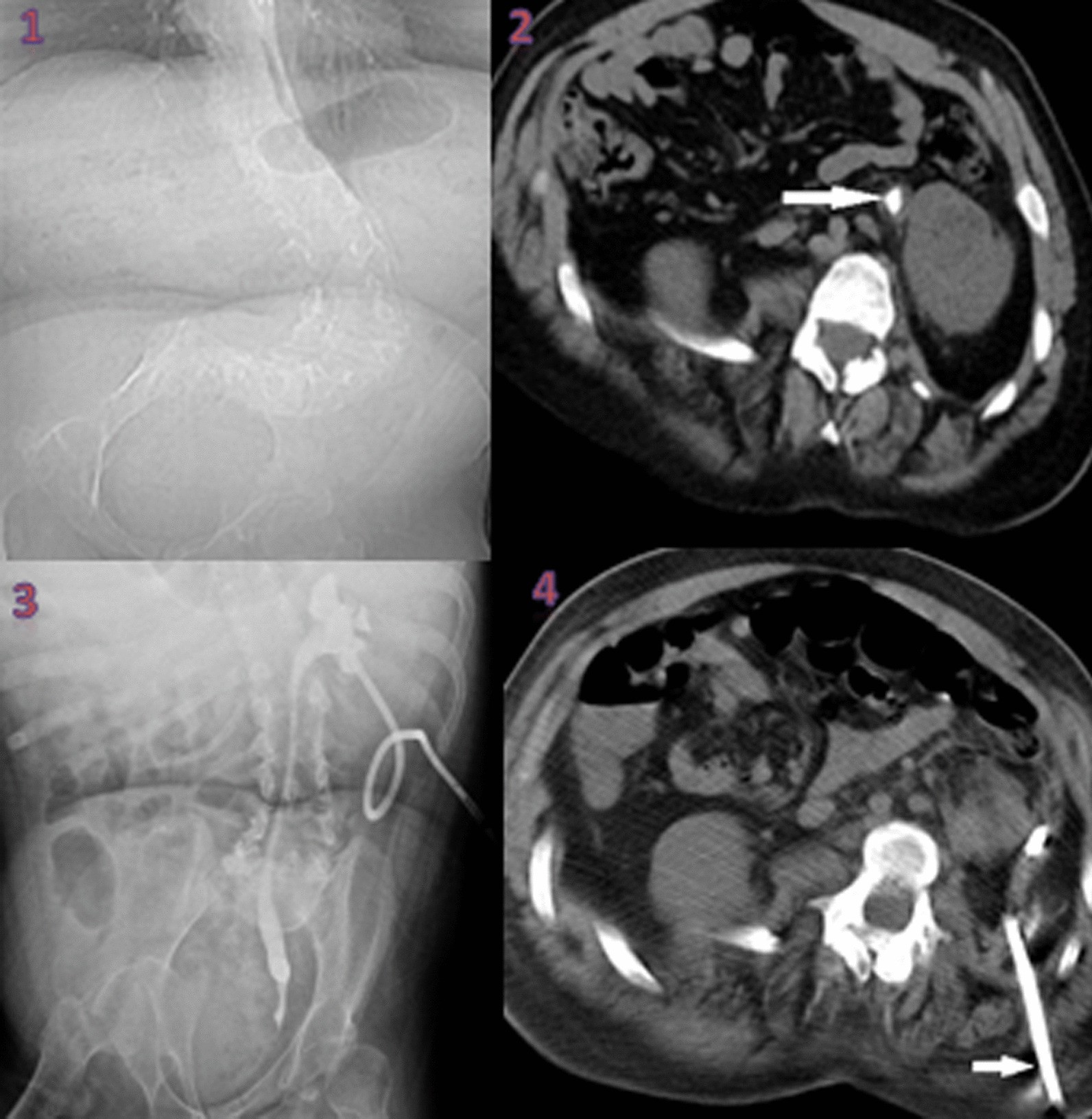 Fig. 1