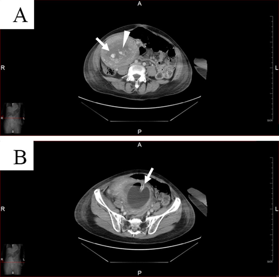 Fig. 2