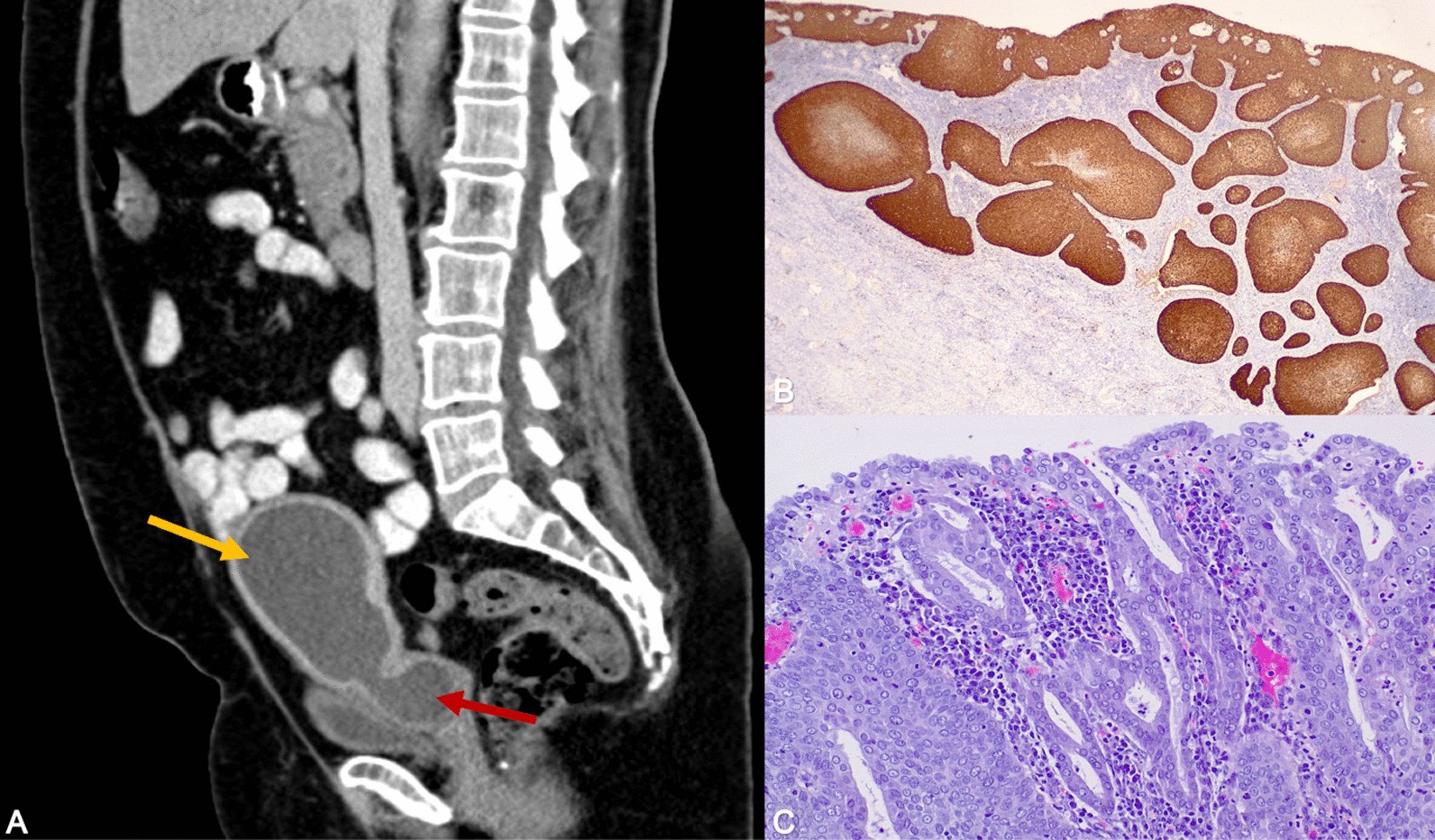 Fig.1