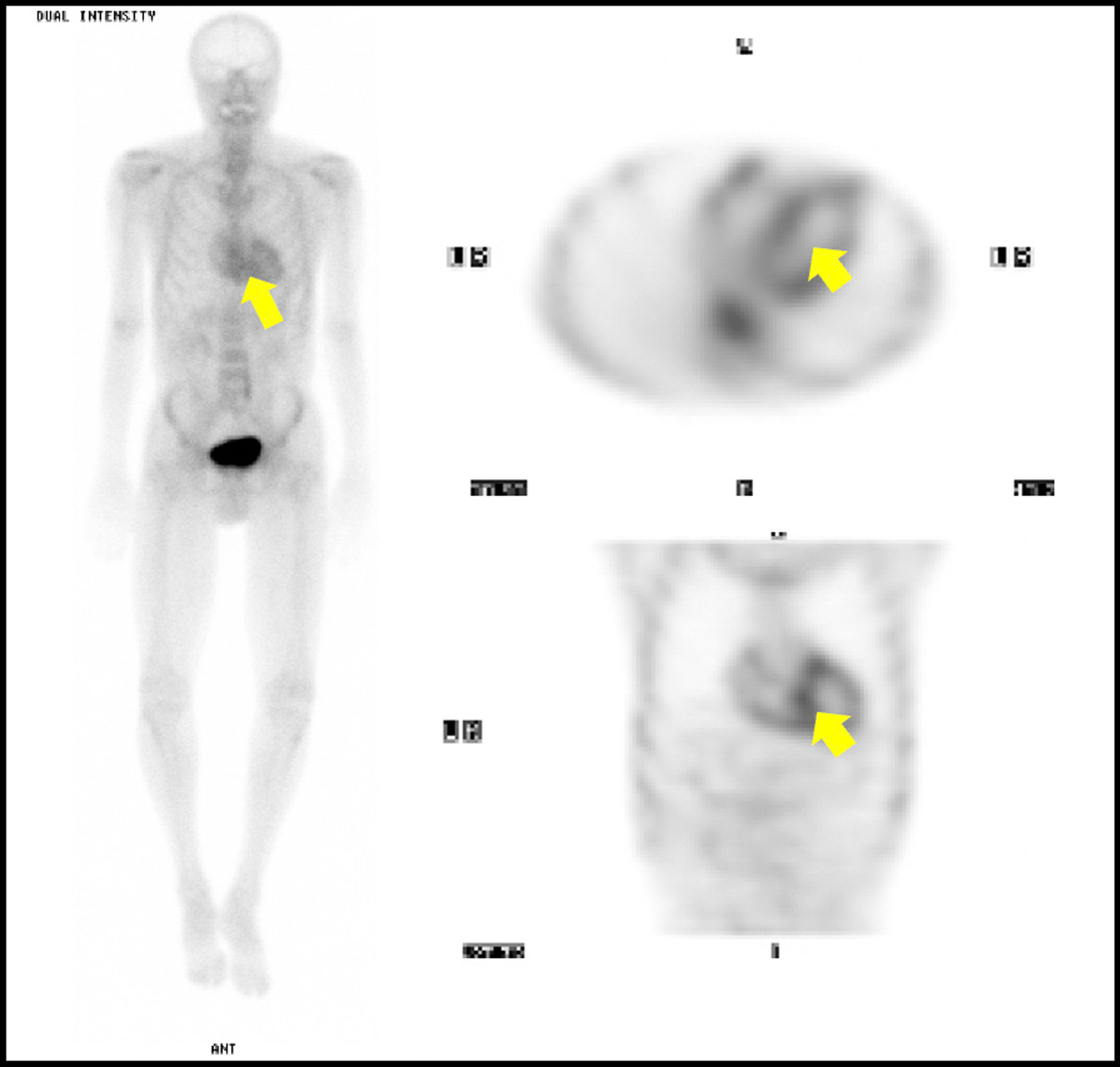 Fig.  1