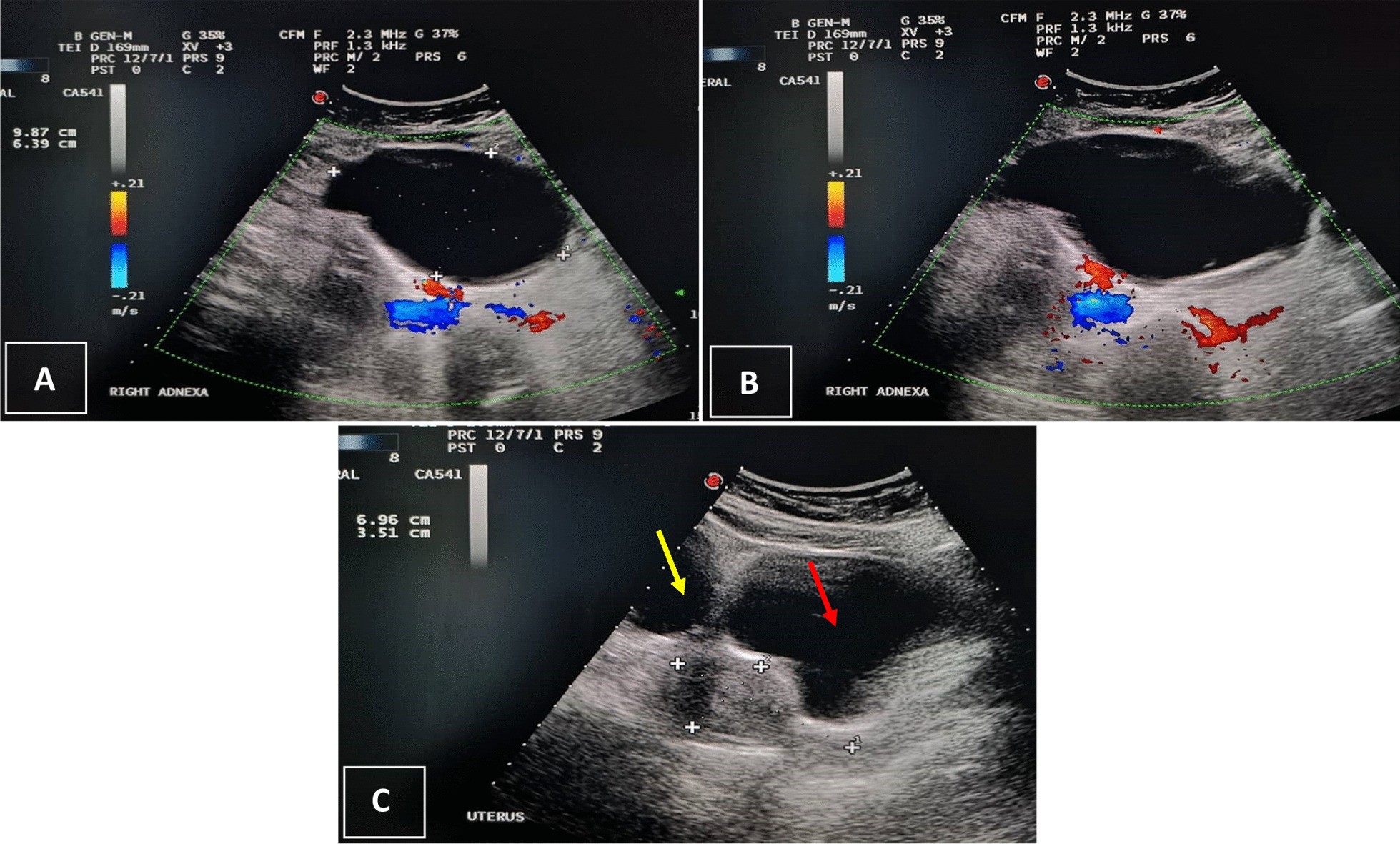 Fig. 1