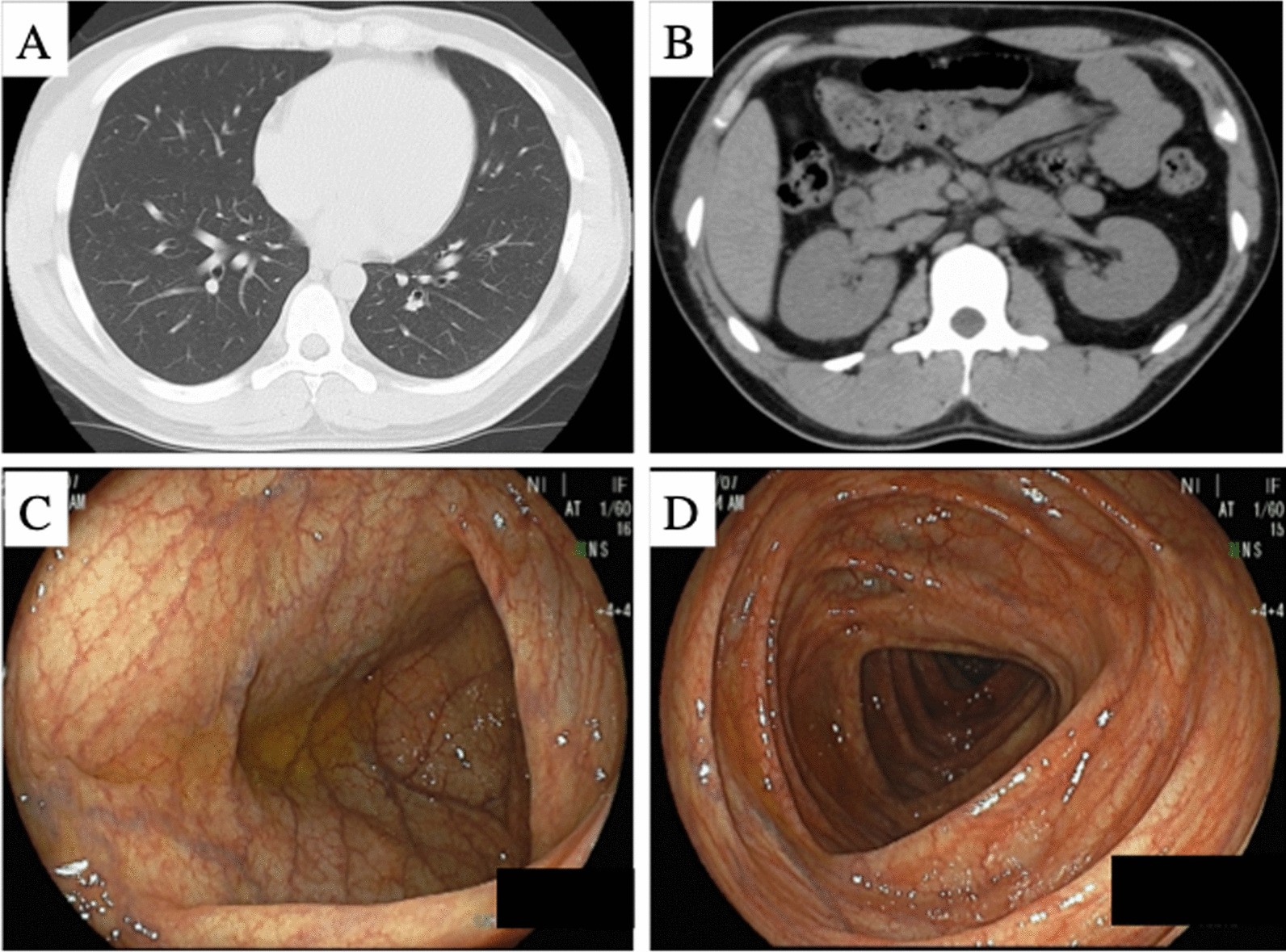 Fig. 1