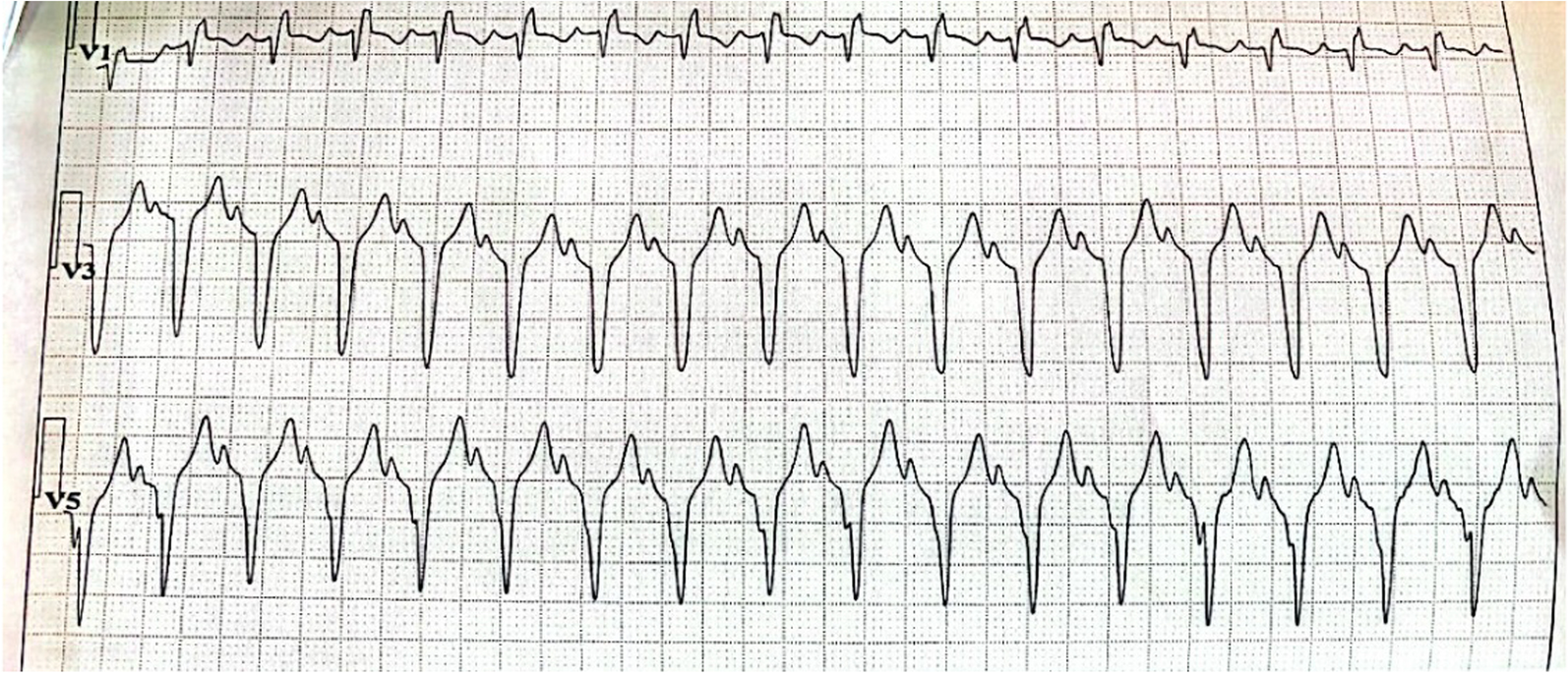 Fig. 3