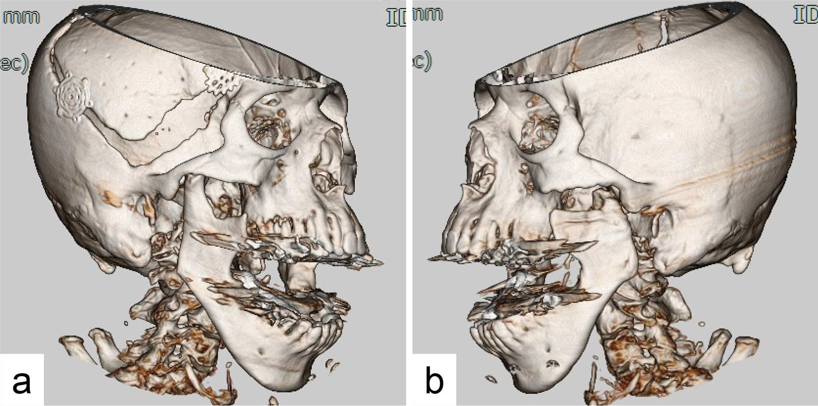 Fig. 2