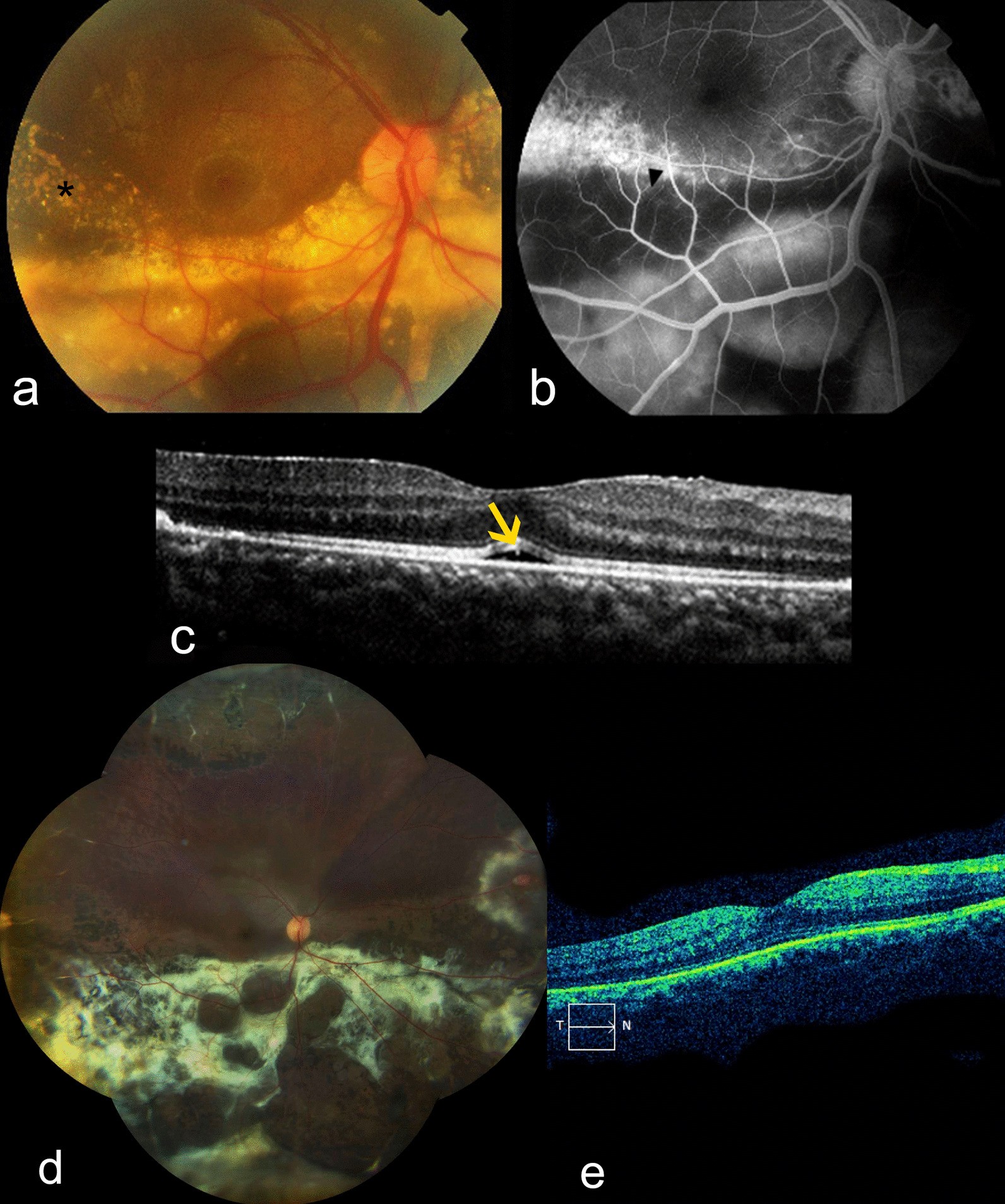 Fig. 1