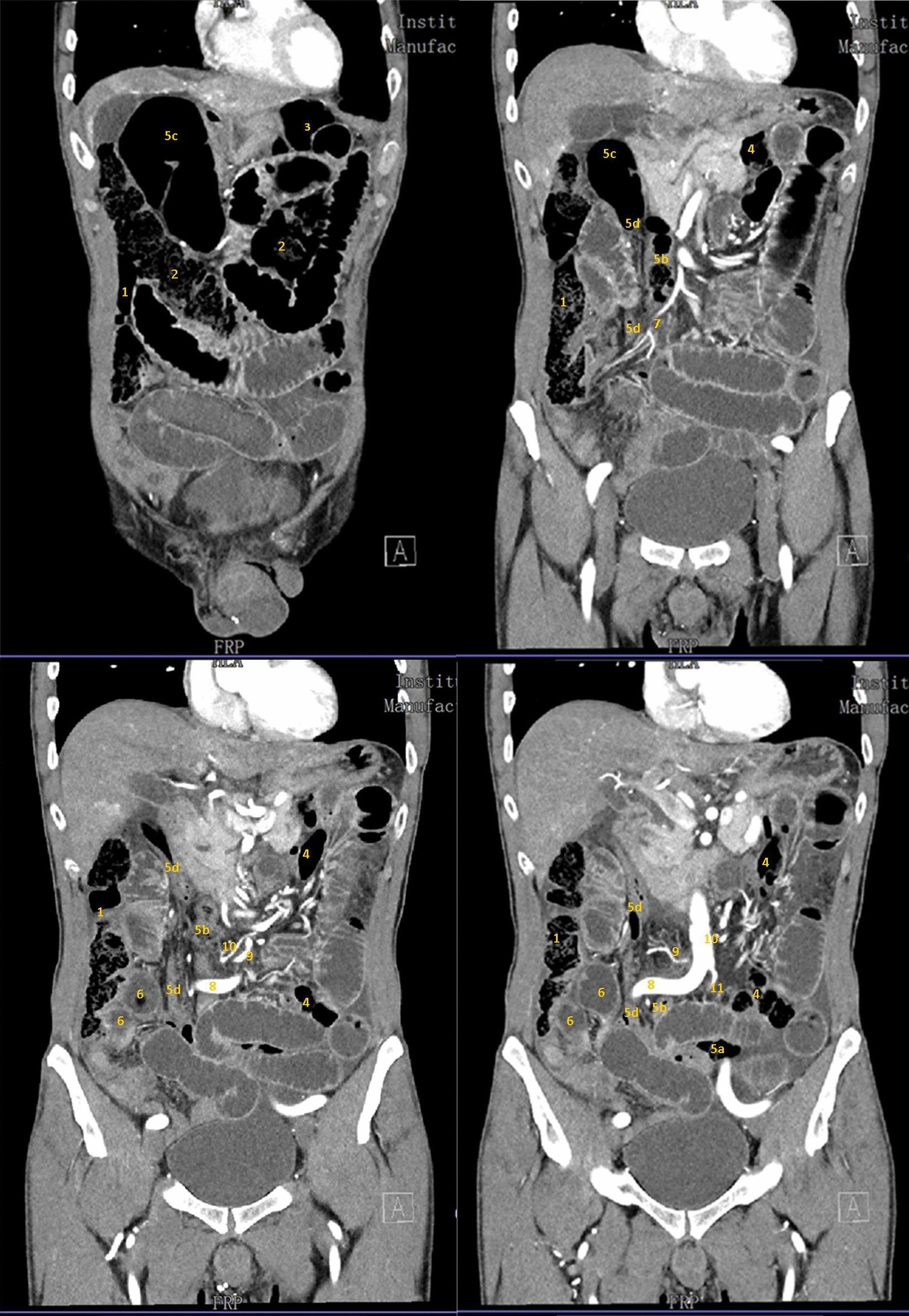 Fig. 2