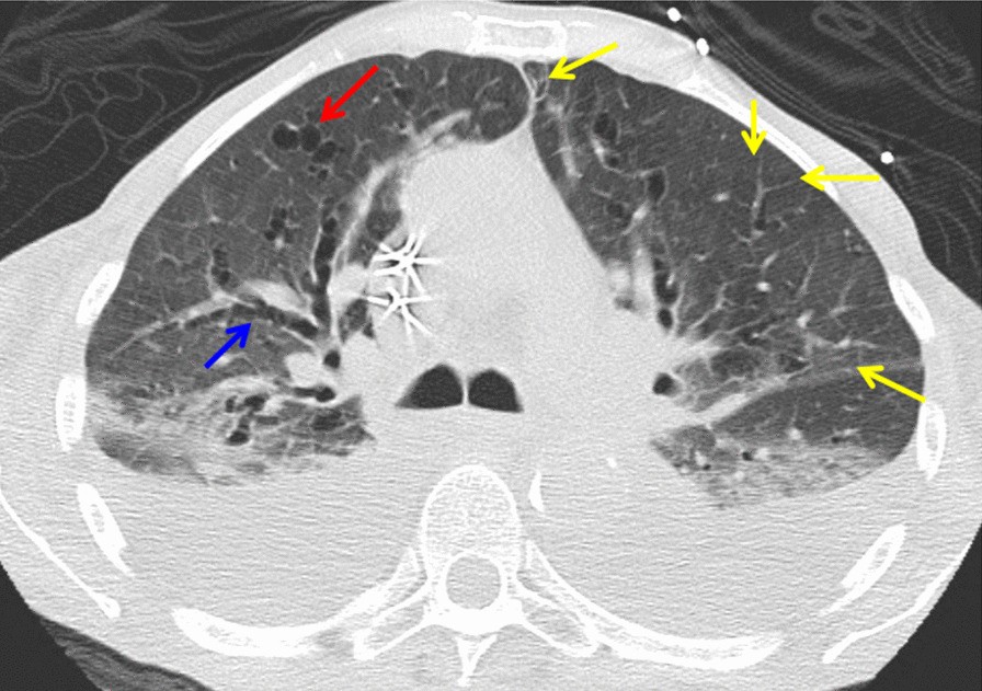 Fig. 2