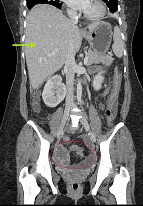 Fig. 2