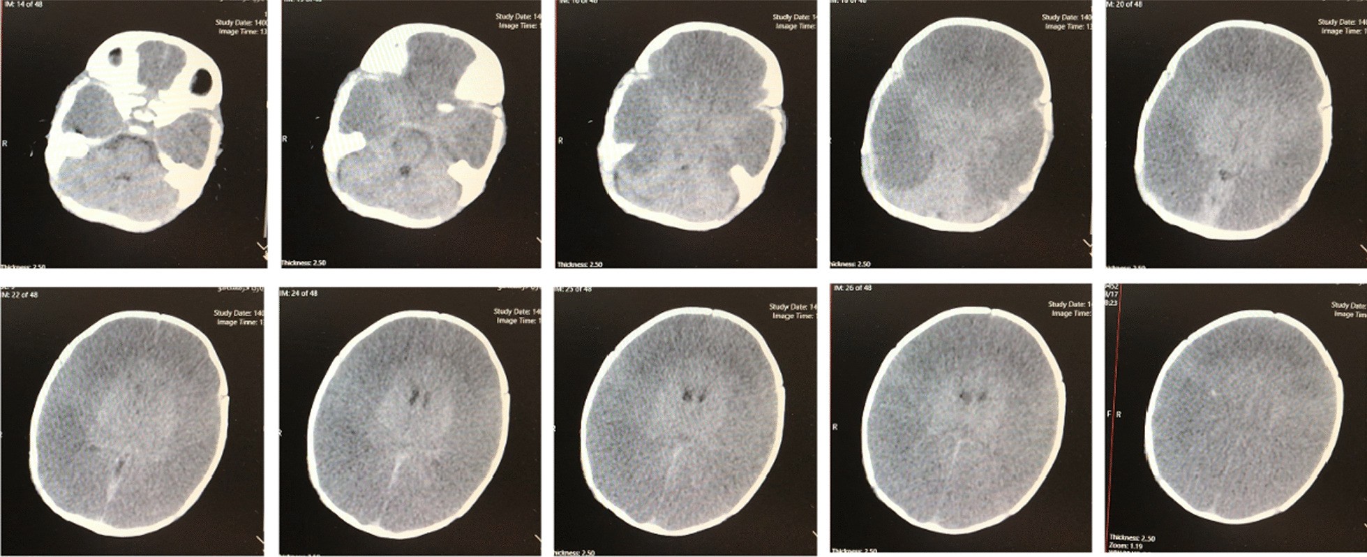 Fig. 2