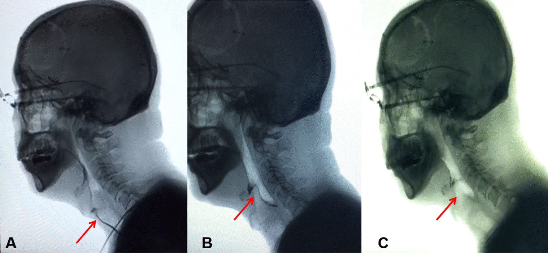 Fig. 1