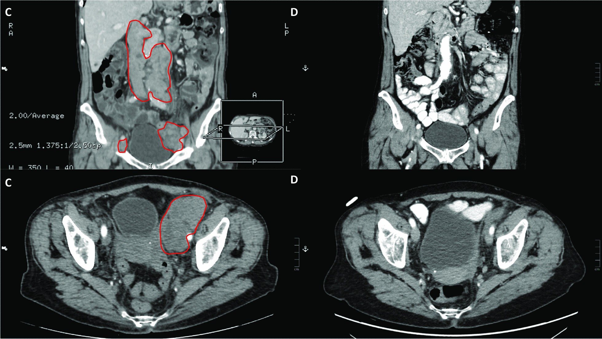 Fig. 3