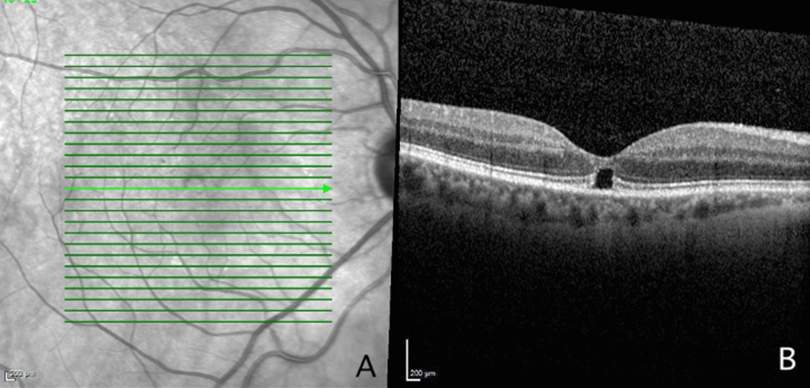 Fig. 2