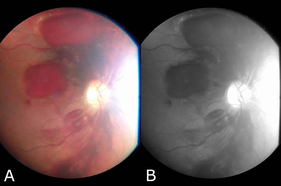 Fig. 2