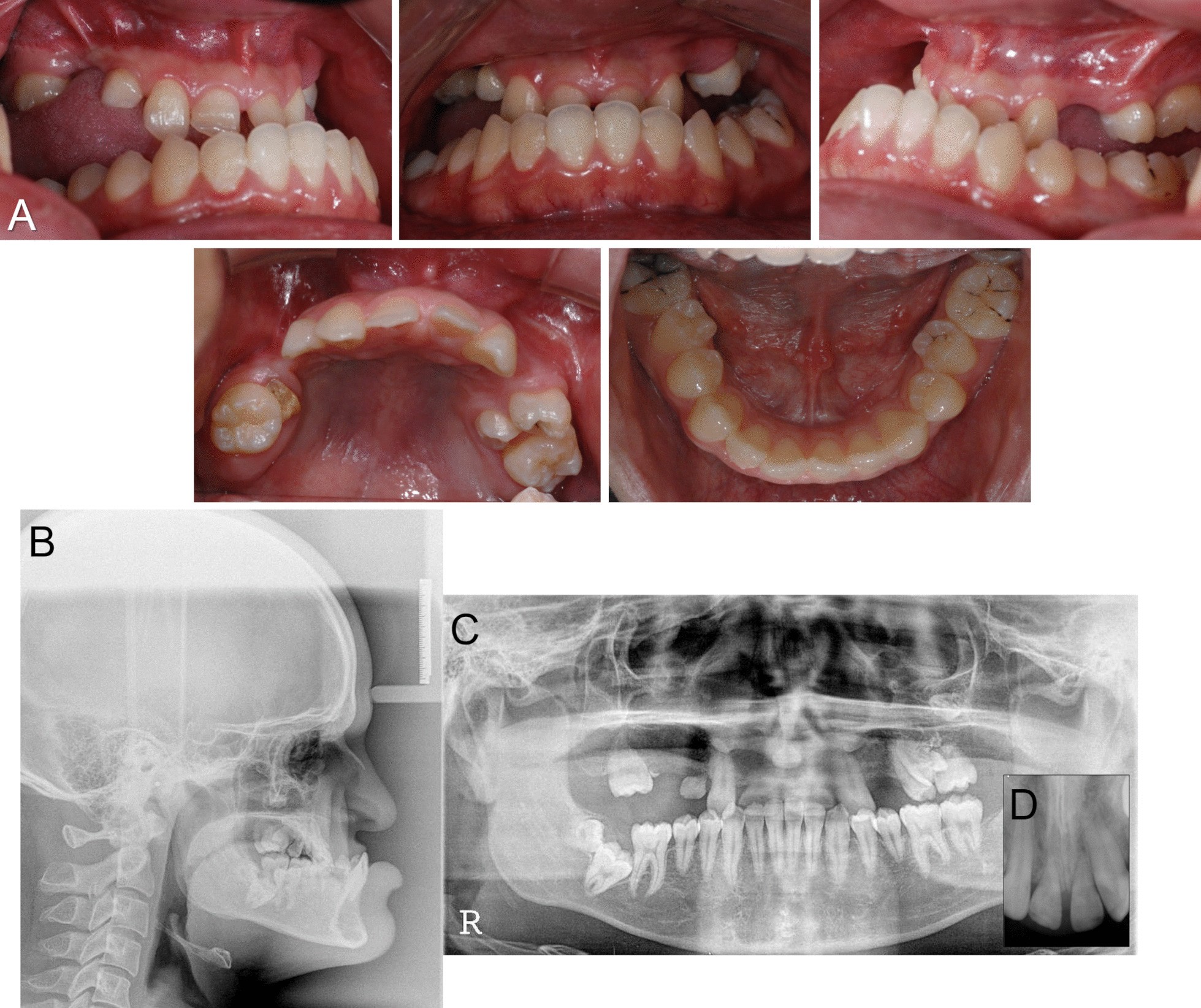 Fig. 1