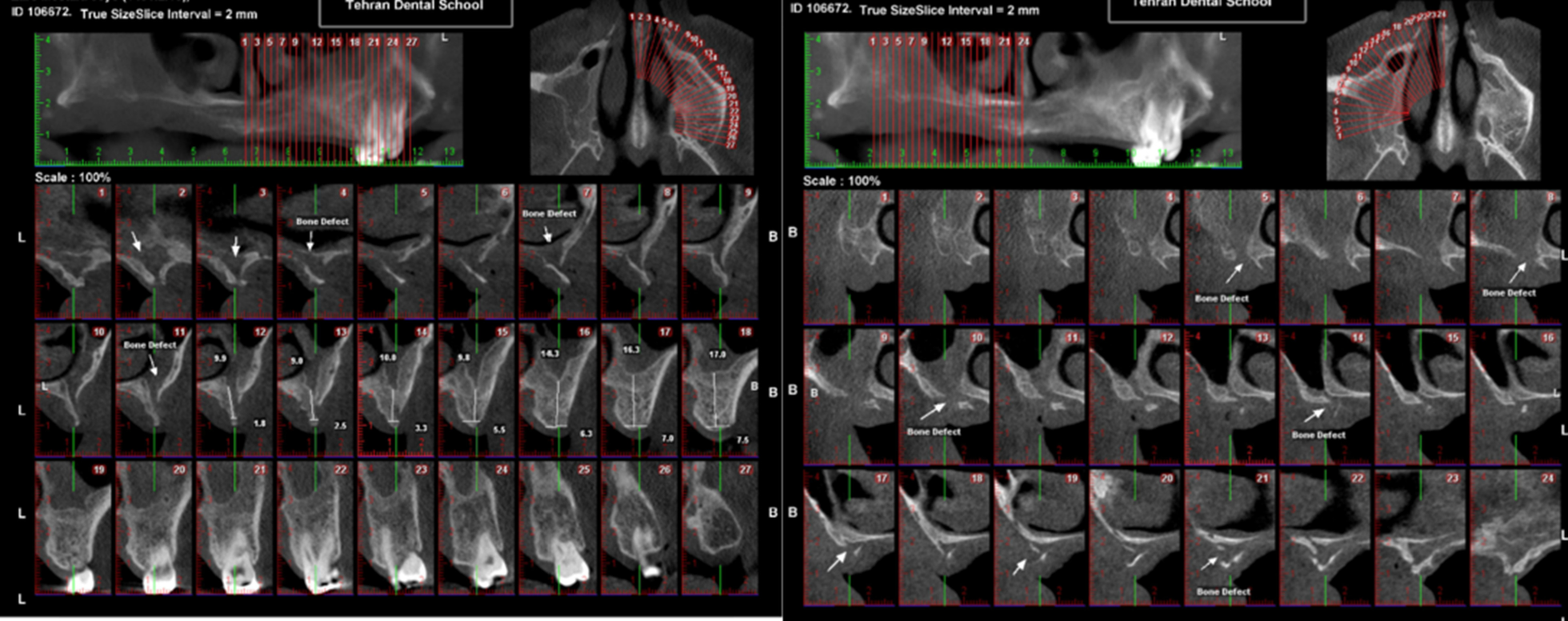 Fig. 6