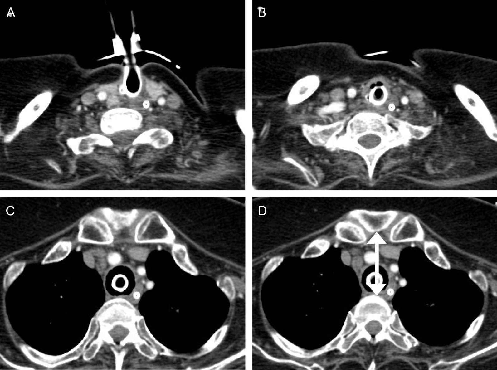 Fig.1