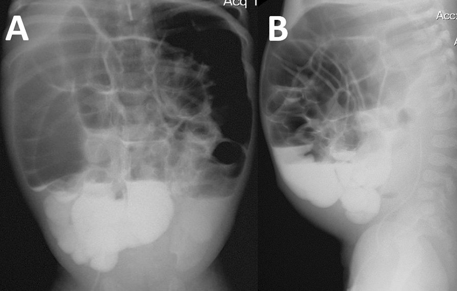 Fig. 2