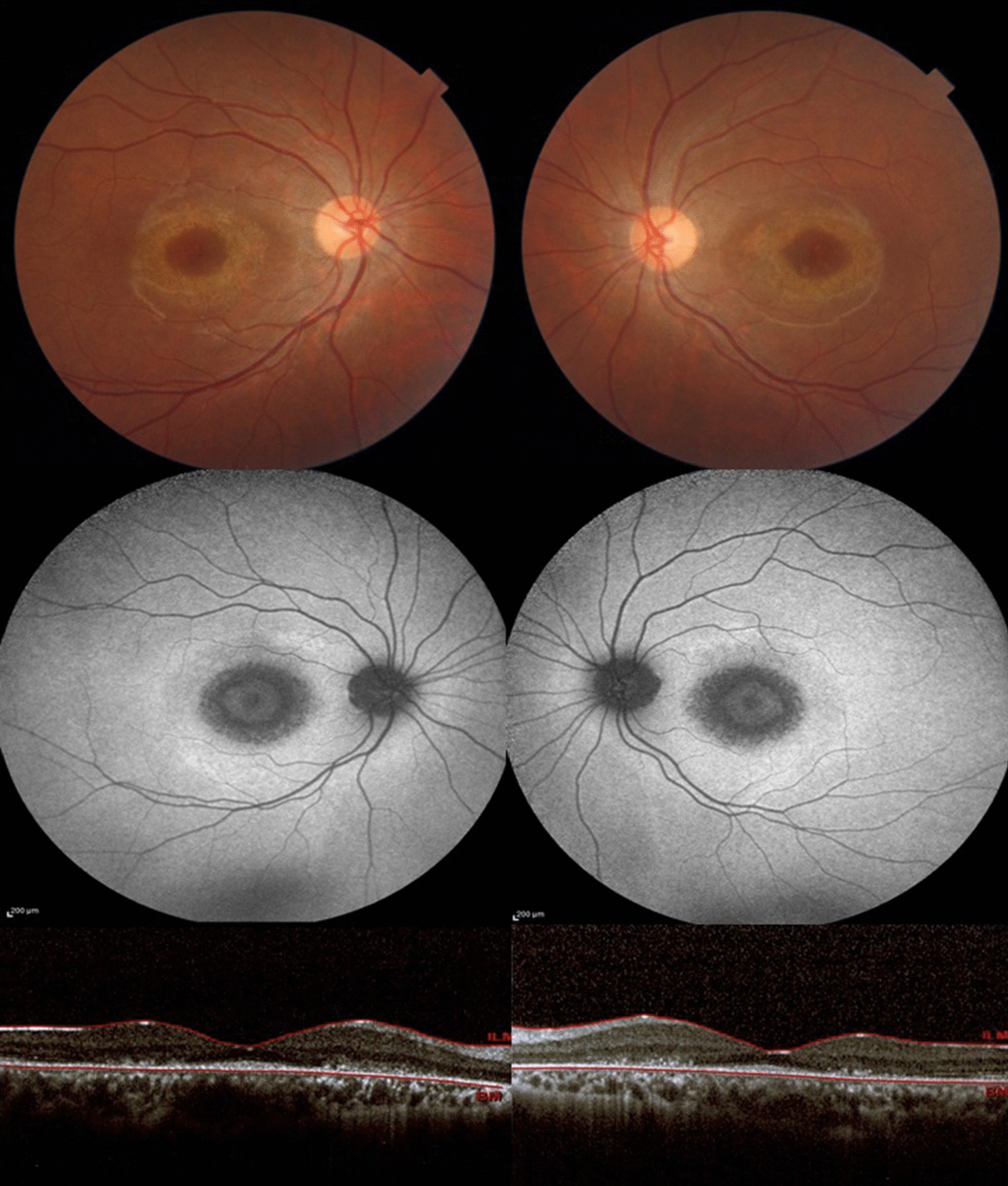 Fig. 1