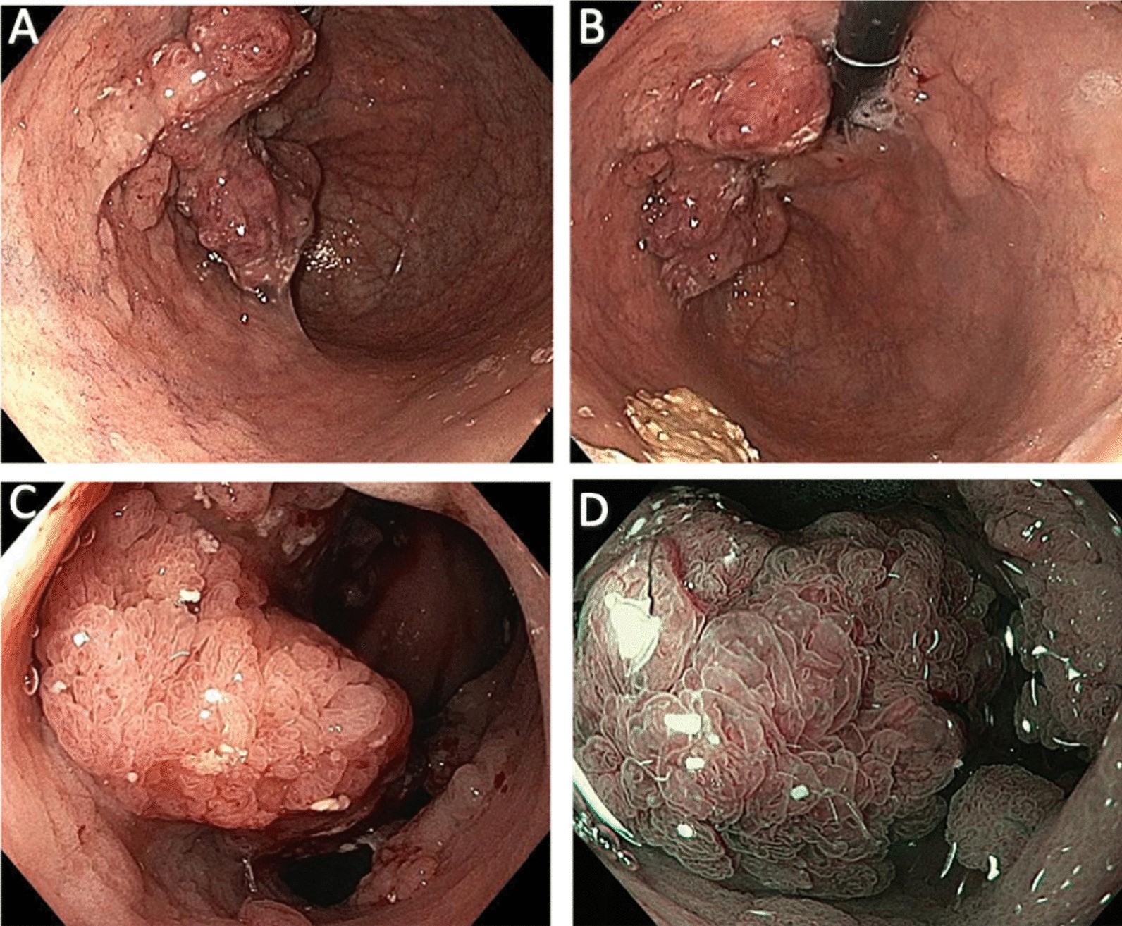 Fig. 2