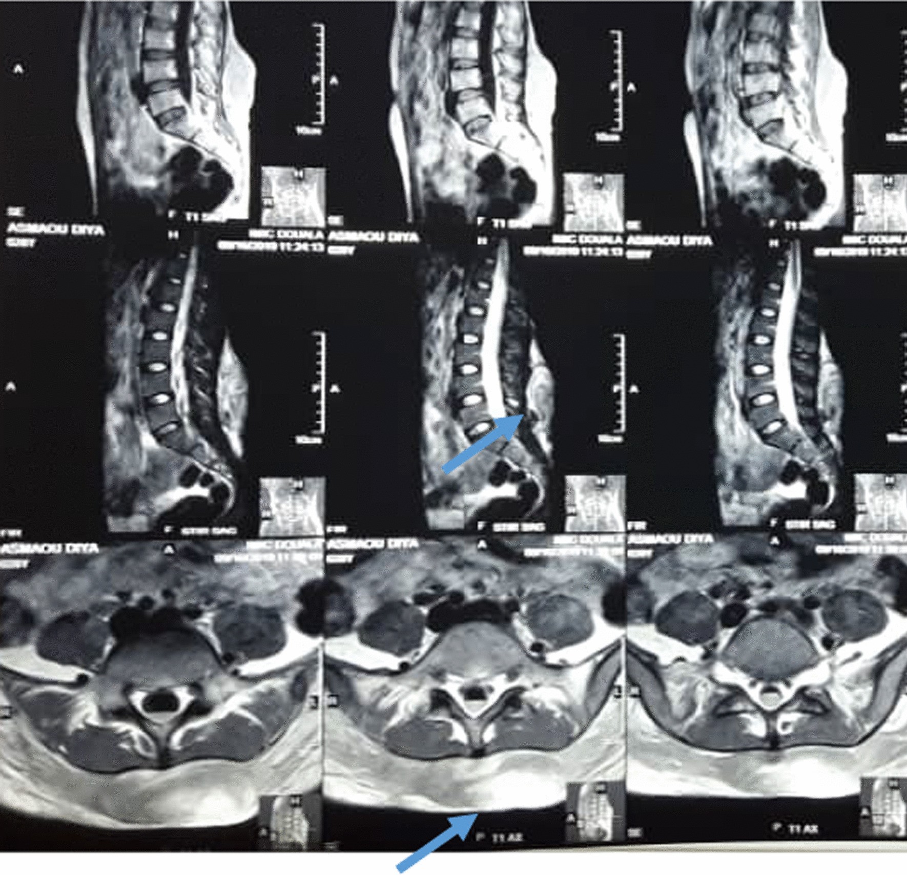 Fig. 2