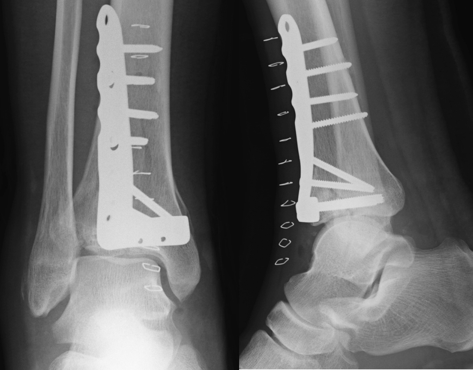 Fig. 2