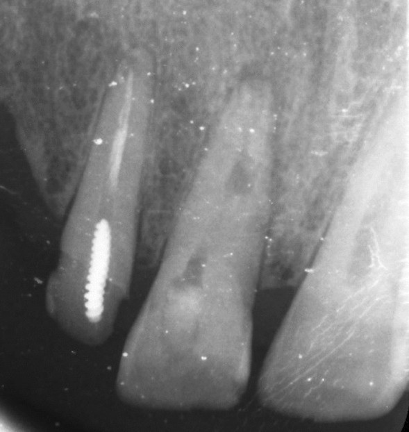 Fig. 1
