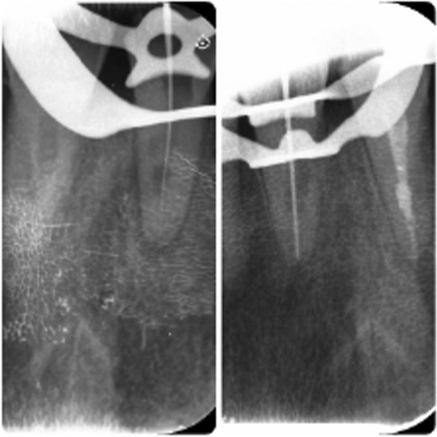 Fig. 4