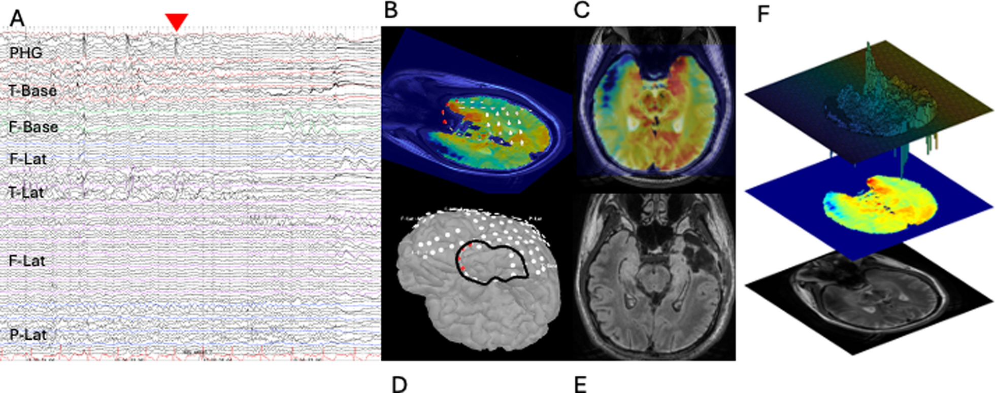 Fig. 1