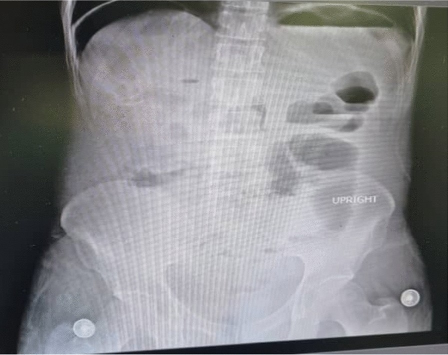 Fig. 3