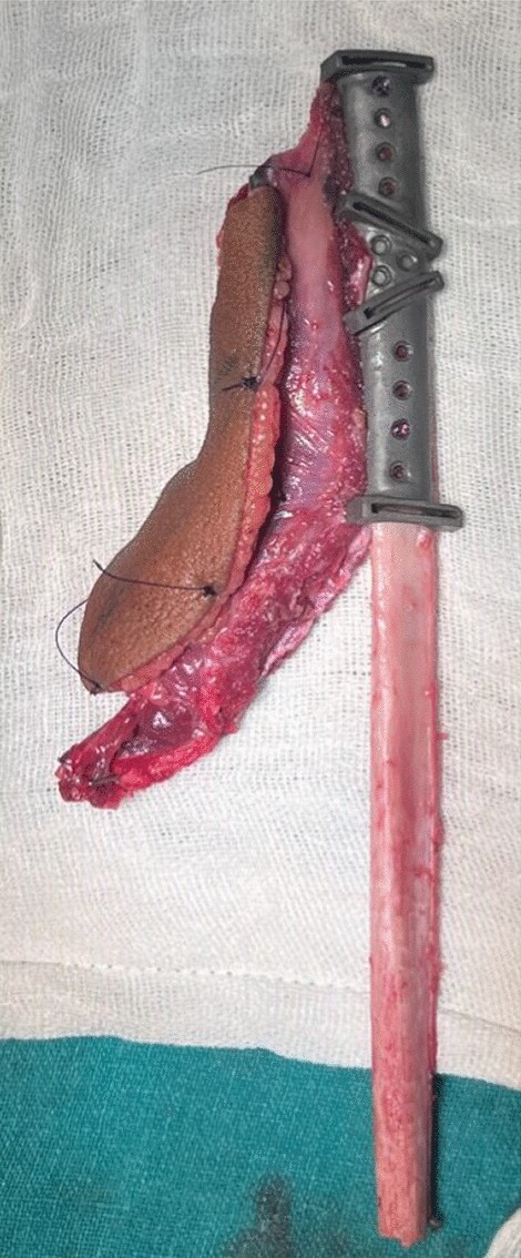 Fig. 9
