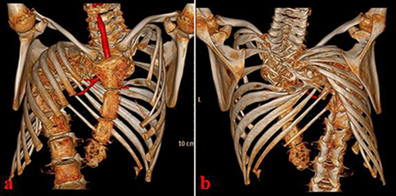 Fig. 3