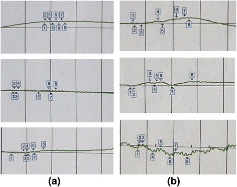 Fig. 3