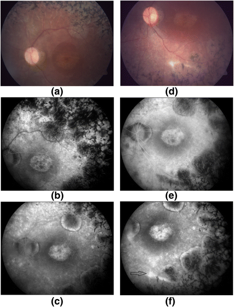 Fig. 5