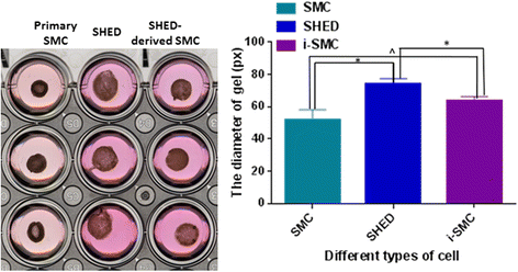 TGF-β1-induced differentiation of SHED into functional smooth muscle cells  | Stem Cell Research & Therapy | Full Text