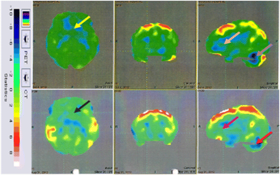 Fig. 7