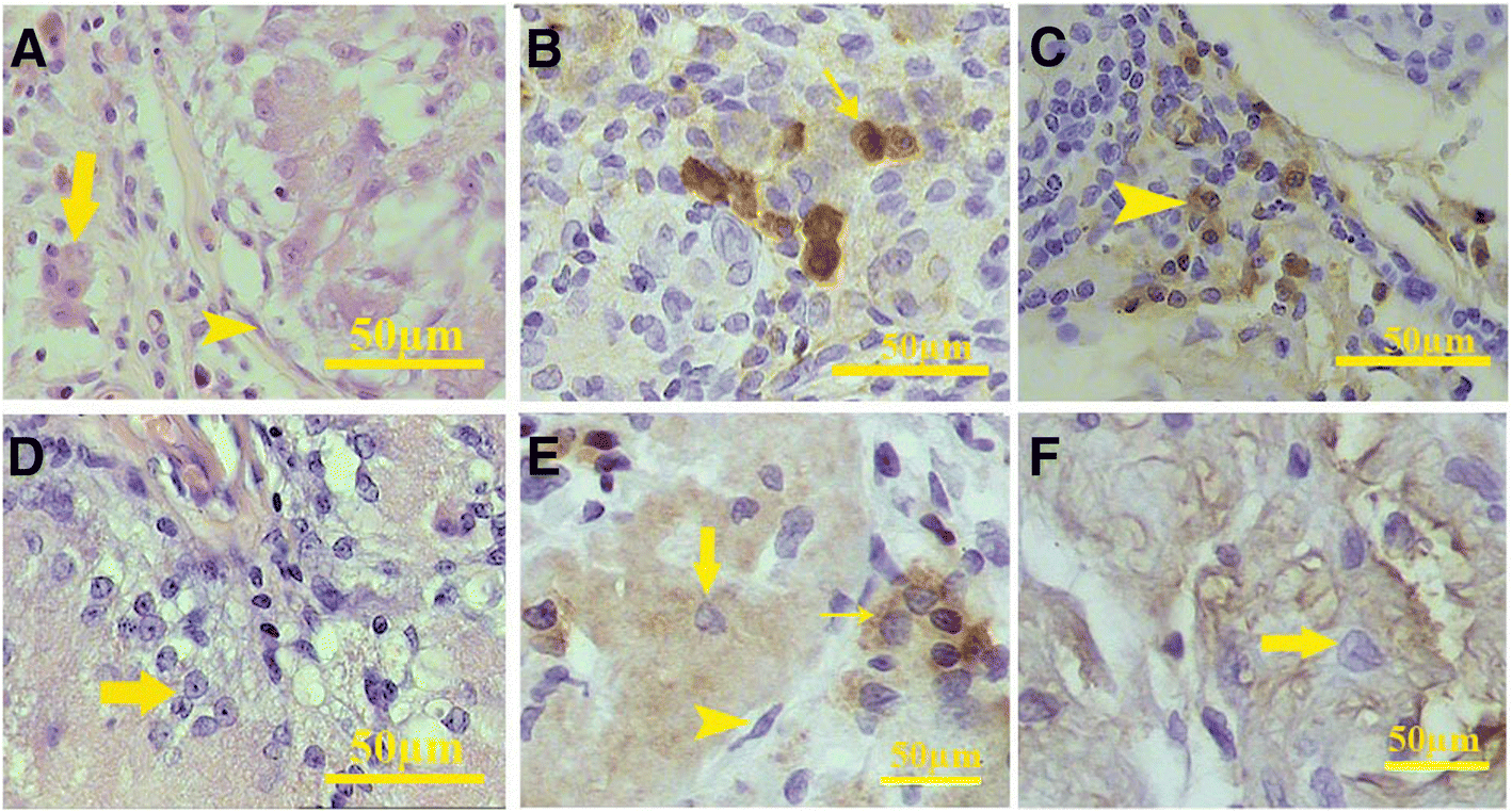 Fig. 12