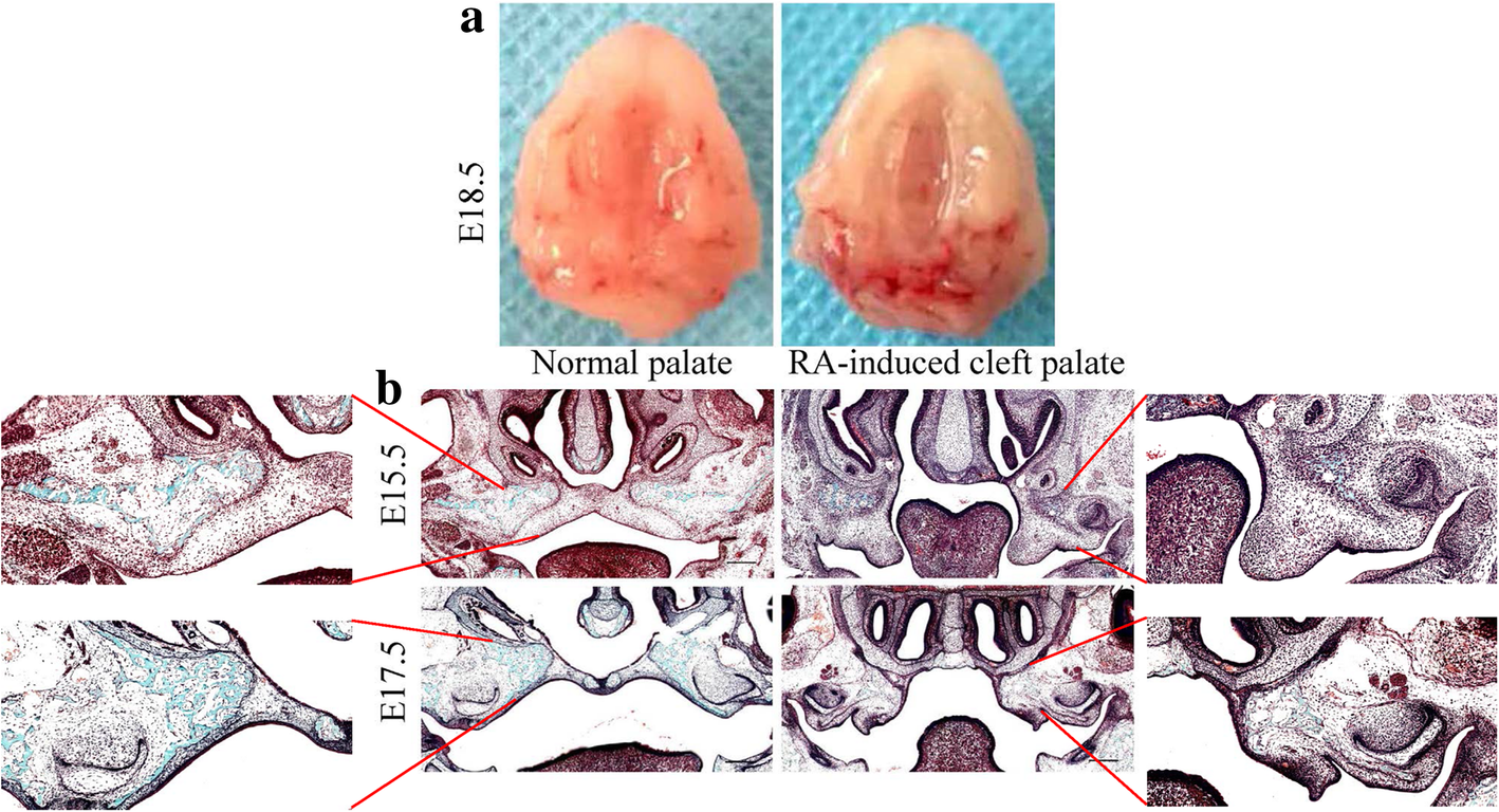 Fig. 10