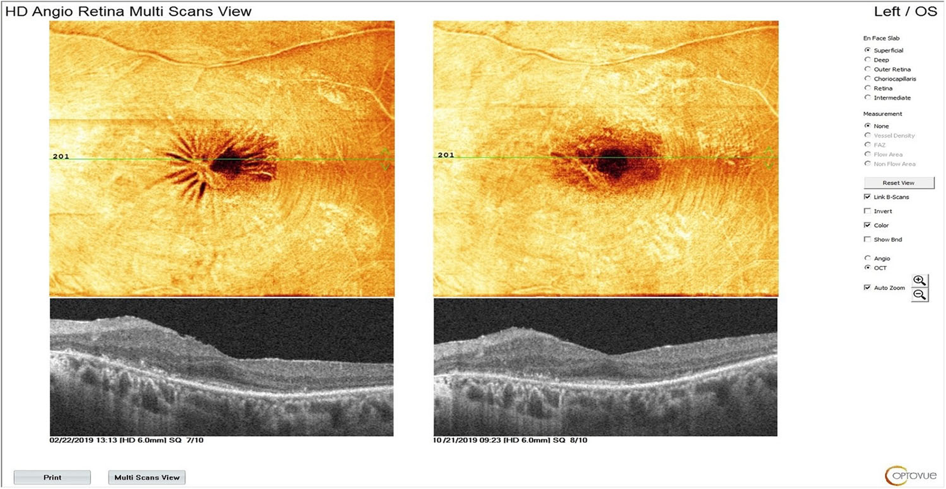 Fig. 10