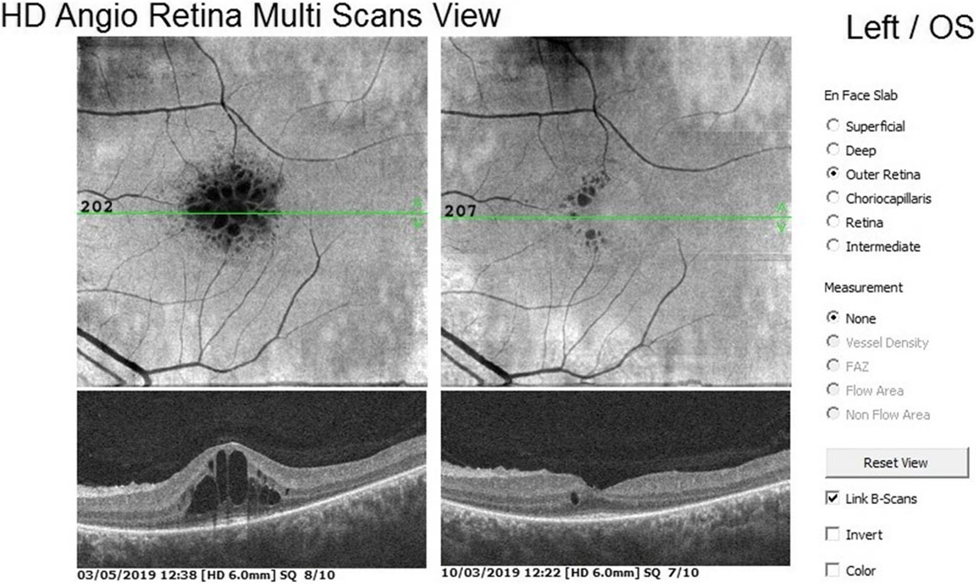 Fig. 9