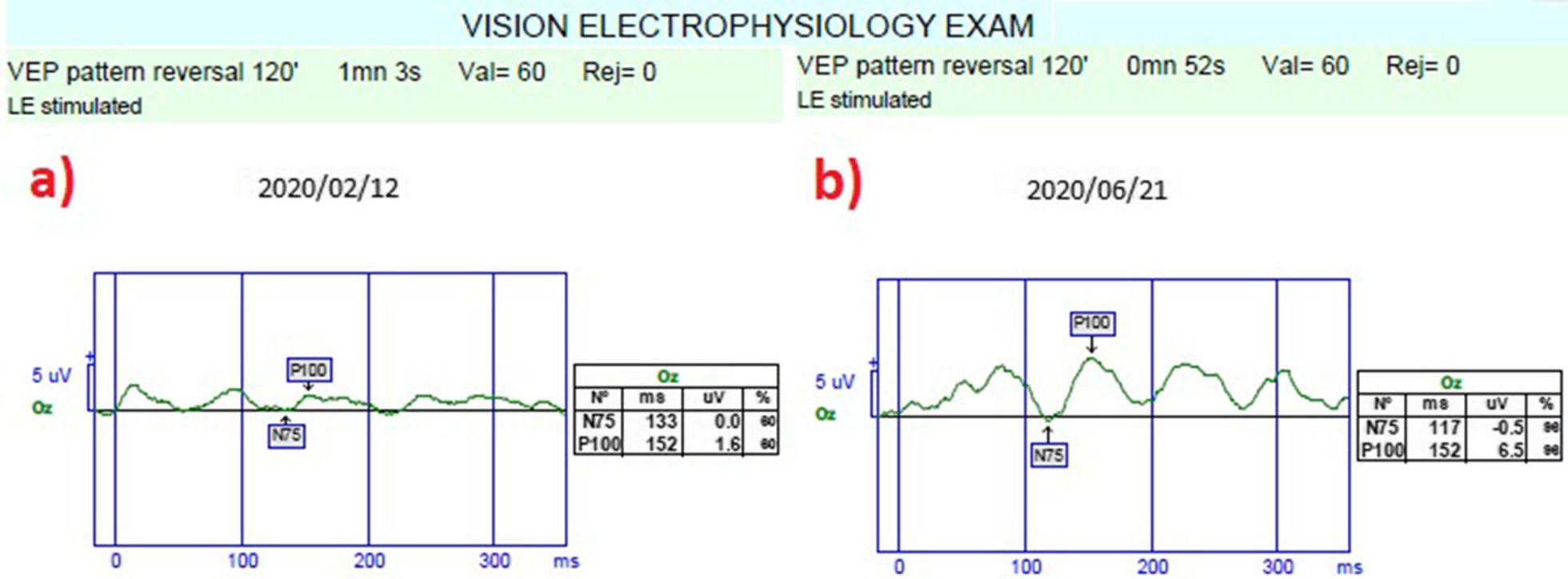 Fig. 11