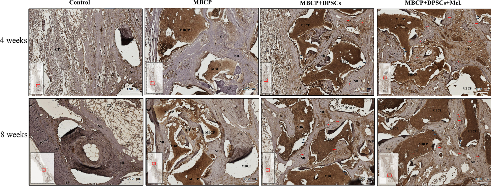 Fig. 14