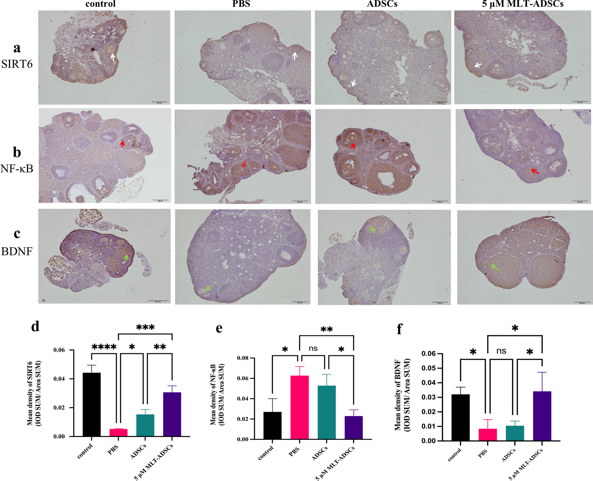 Fig. 11