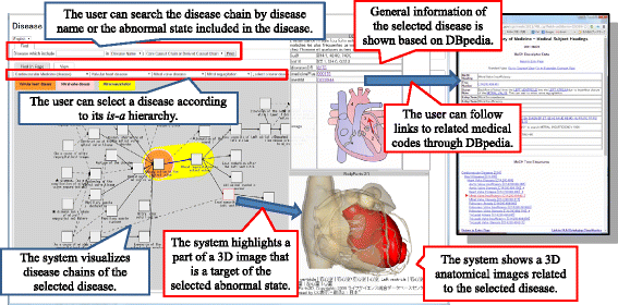 Fig. 12