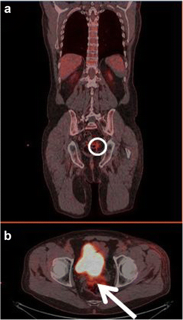 Fig. 6