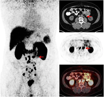 Fig. 2