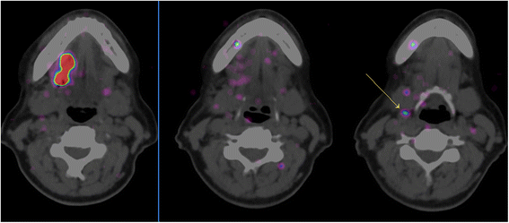 Fig. 3