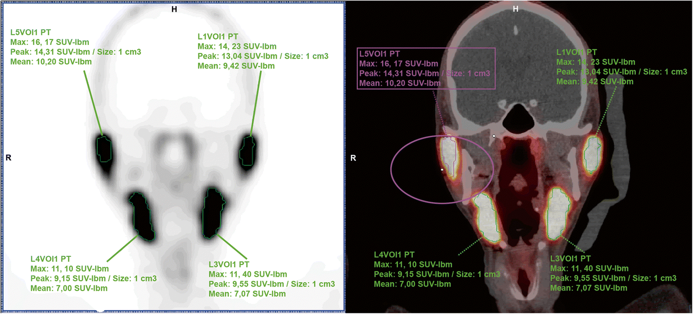 Fig. 2