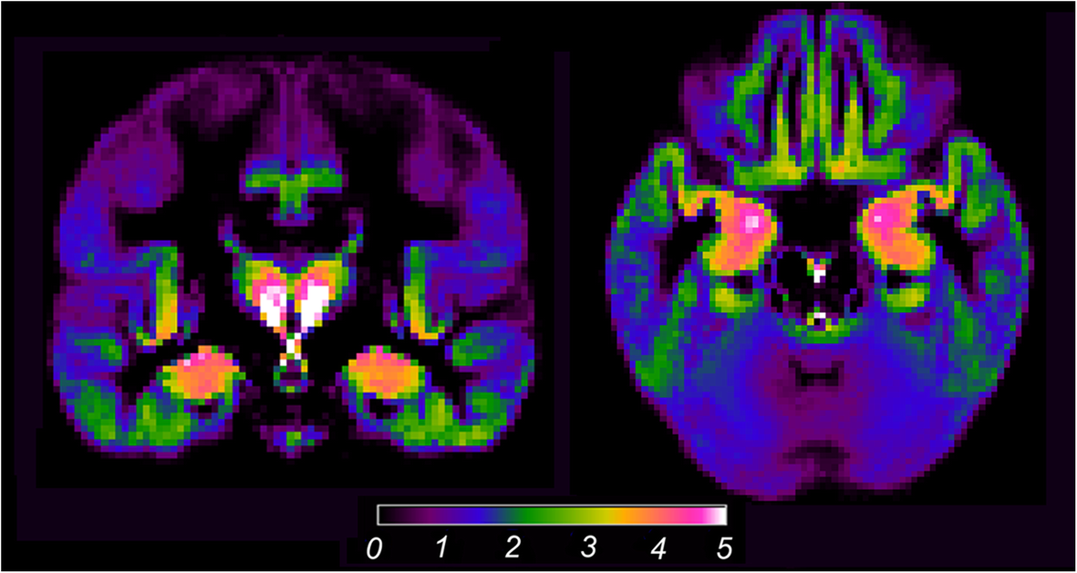 Fig. 1