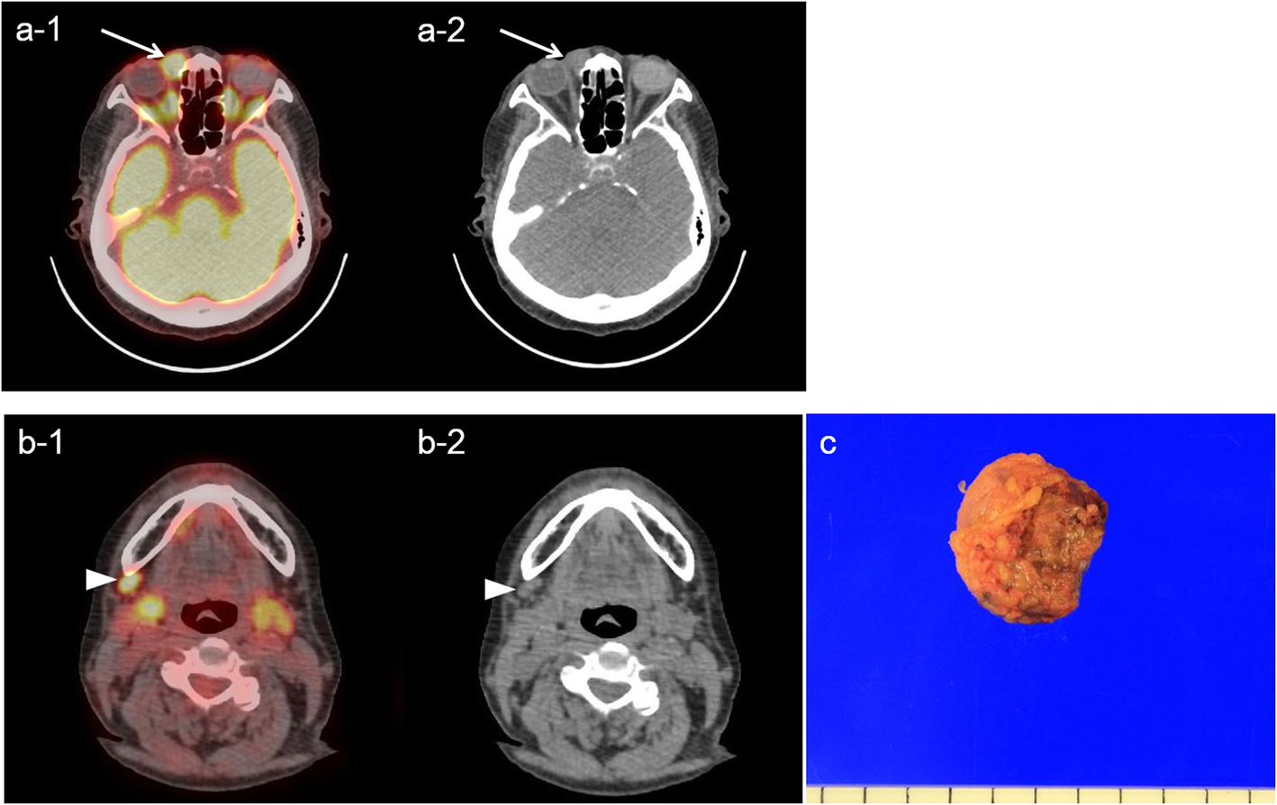 Fig. 3