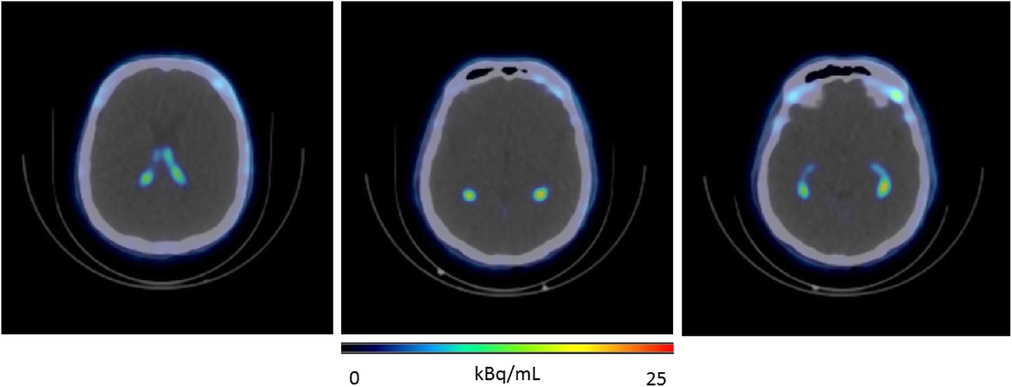 Fig. 2